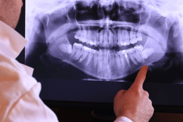 Best Emergency Wisdom Teeth Removal in Red Boiling Springs, TN